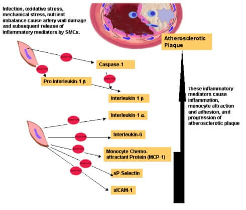 Cardiovascular Diseases心血管疾病－流式细胞因子检测